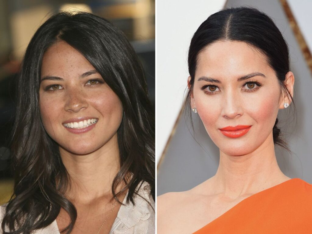 Olivia Munn Before and after surgery