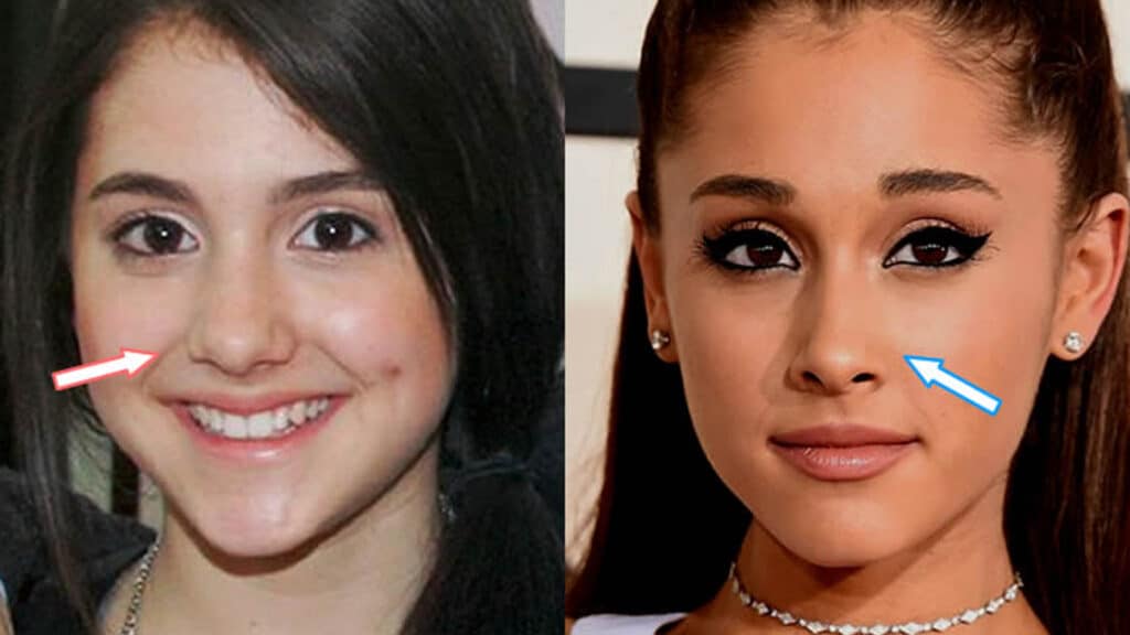 Ariana Grande Plastic Surgery Transformation