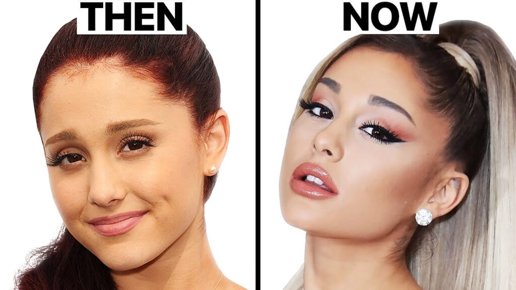 Ariana Grande Plastic Surgery before and after