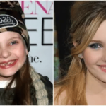 Abigail Breslin Teeth