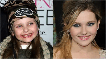 Abigail Breslin Teeth