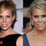 Cheryl Hines before and after Plastic Surgery