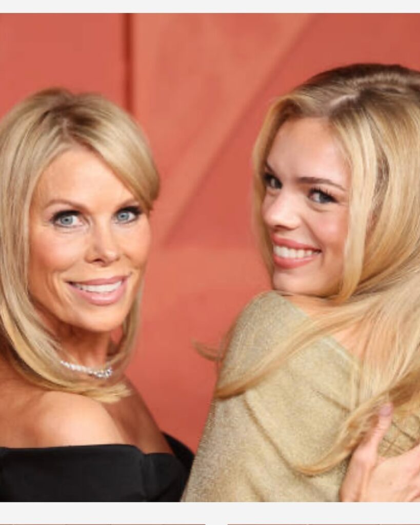 Cheryl Hines Teeth Before and After