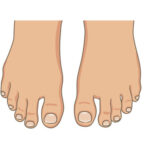 Why Are My Toenails So Small?