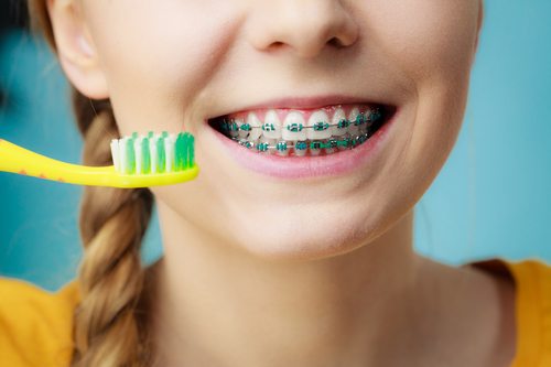 What Happens If You Don’t Brush Your Teeth with Braces?