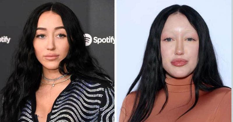 What Happened to Noah Cyrus Eyebrows?