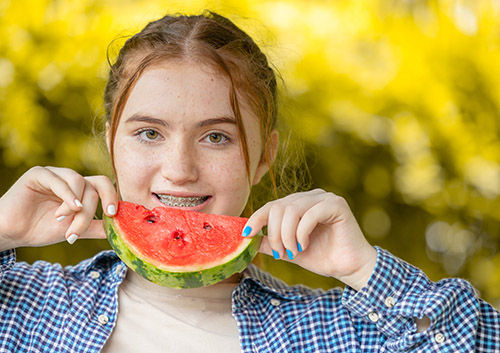 Eating Watermelon with Braces