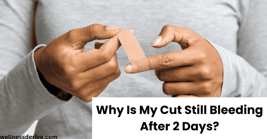 Why Is My Cut Still Bleeding After 2 Days?