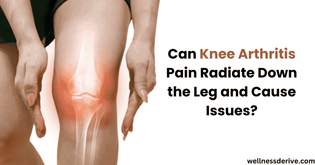 Can Knee Arthritis Pain Radiate Down the Leg and Cause Issues?