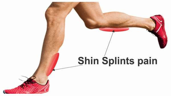 Shin Pain