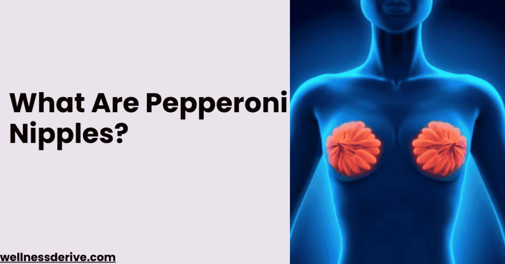 What Are Pepperoni Nipples?