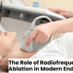 The Role of Radiofrequency Ablation in Modern Endocrinology