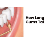 How Long Do Cut Gums Take to Heal