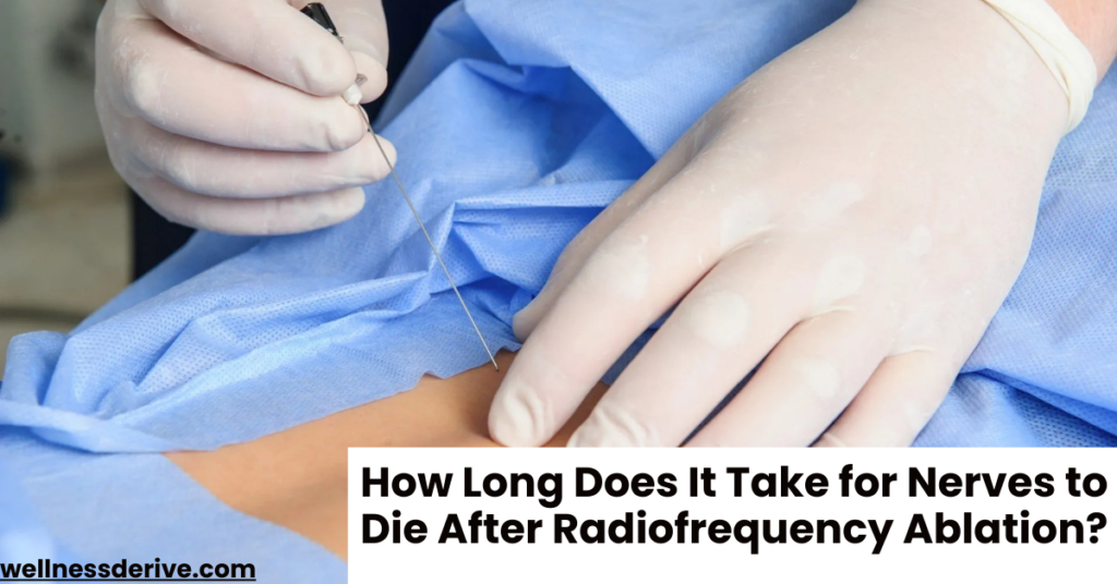 How Long Does It Take for Nerves to Die After Radiofrequency Ablation