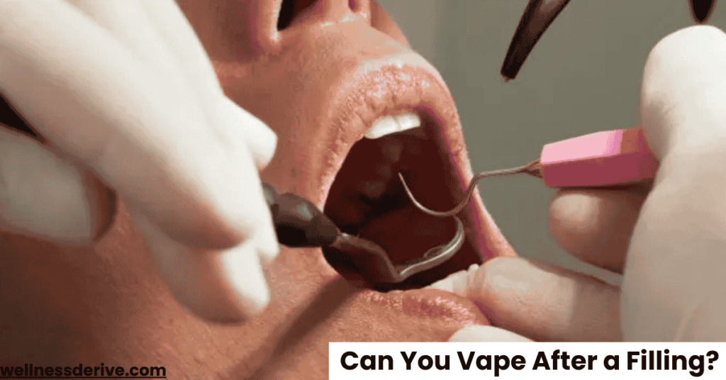 Can You Vape After a Filling