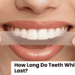 How Long Do Teeth Whitening Strips Last