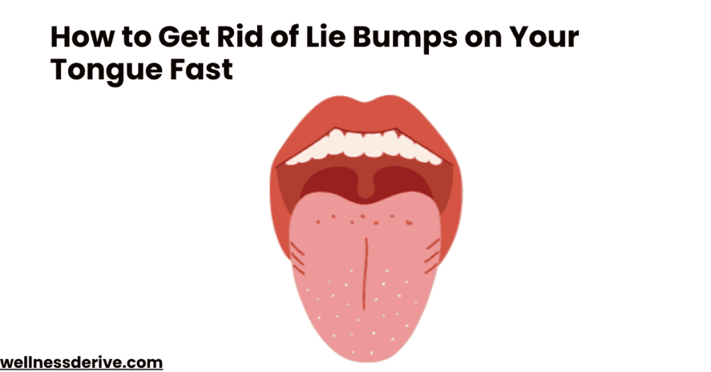 How to Get Rid of Lie Bumps on Your Tongue Fast