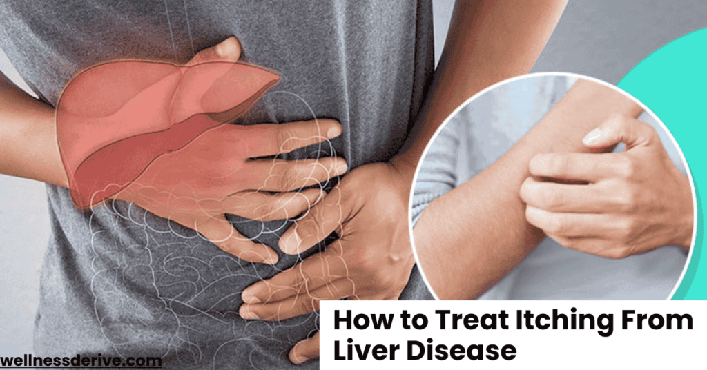 How to Treat Itching From Liver Disease