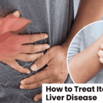 How to Treat Itching From Liver Disease