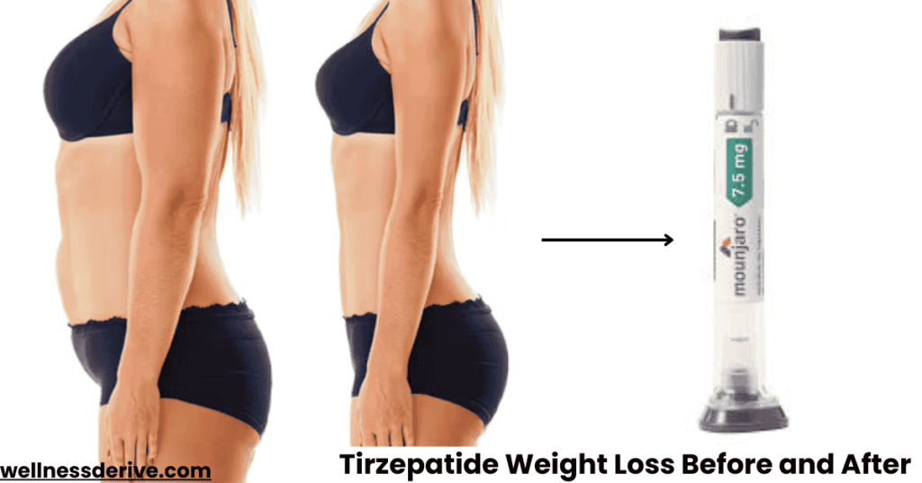 Tirzepatide Weight Loss Before and After