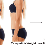 Tirzepatide Weight Loss Before and After