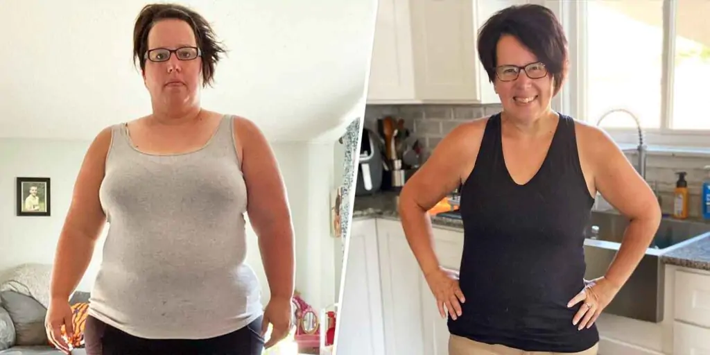 Tirzepatide Weight Loss Before and After