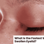 What Is the Fastest Way to Heal a Swollen Eyelid