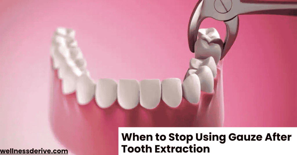 When to Stop Using Gauze After Tooth Extraction