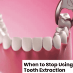 When to Stop Using Gauze After Tooth Extraction