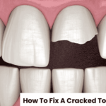 how to fix a cracked tooth naturally