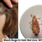 Black Bugs in Hair Not Lice