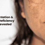 Hyperpigmentation & Vitamin B12 Deficiency Symptoms Revealed
