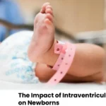 The Impact of Intraventricular Hemorrhage on Newborns
